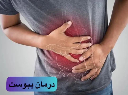 تصویر شماتیک دستگاه گوارش و مشکل یبوست